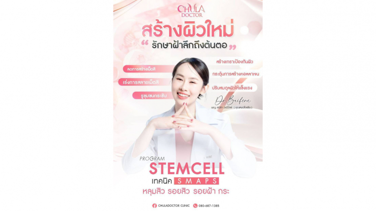 รักษาฝ้า กระ จุดด่างดำ ไปกับ Chuladoctor Anti-Aging Center ด้วยนวัตกรรม smaps เทคนิคการรักษาฝ้าจดสิทธิบัตร ที่แรกและที่เดียวในประเทศไทย