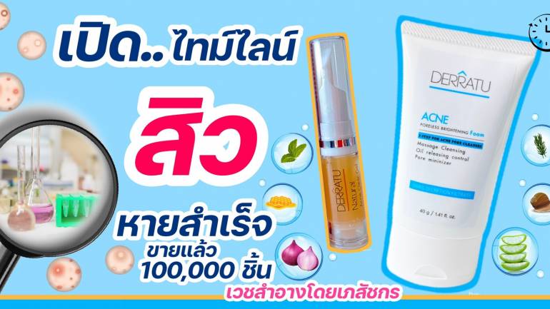 ของมันต้องมี!! ไอเท็ม(ไม่)ลับที่จะช่วยจัดการปัญหาสารพัด "สิว" ให้จางหายด้วยสูตร 3 in 1