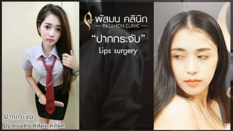 เพิ่มเสน่ห์ให้ใบหน้า ด้วยรูปปากสวยละมุน จาก “พัสมนคลินิก” เพราะเรายืนหนึ่งเรื่องทำปากกระจับ!